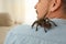 Man with tarantula at home. Arachnophobia fear of spiders
