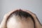 Man touching her hair close up on gray background, hair loss concept.