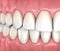 Mandibular human gum and teeth anatomy. Medically accurate tooth illustration