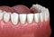 Mandibular human gum and teeth. Medically accurate tooth illustration