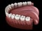 Mandibular human gum and teeth. Medically accurate tooth illustration