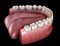 Mandibular human gum and teeth. Medically accurate tooth illustration