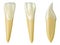 Mandibular lateral incisor tooth in the buccal, palatal and lateral views. Realistic 3d illustration of mandibular lateral incisor