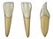 Mandibular lateral incisor tooth in the vestibular, palatal and lateral views with black wireframe wrapping the tooth