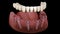 Mandibular prosthesis All on 4 system supported by implants. Medically accurate 3D animation of human teeth and dentures concept