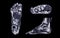 Manetic resonance imaging of foot or MRI FOOT PDW axial, Coronal and sagittal view for diagnostic tendon injury