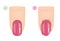 Manicure Mistakes. How to Remove Nail Polish from Around the Nails. Manicure Guide. Vector