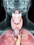 A mans throat anatomy