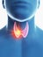 A mans thyroid gland cancer