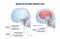 Masticatory muscles and cheek bones muscular system anatomy outline diagram