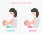 Mastitis, breastfeed, medical infographic. Diagnostics, symptoms