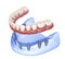 Maxillary and Mandibular prosthesis with gum All on 8 system supported by implants. Medically accurate 3D illustration of human