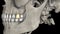 The maxillary second molar is the tooth located distally from both the maxillary first molars