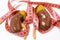 Measurement of kidneys and adrenal as definition of symptom or sign of disease e.g. enlarged kidneys. Kidneys model wrapped by mea