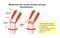 Mechanism and causes of knee joint pain / English