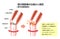 Mechanism and causes of knee joint pain / Japanese