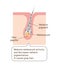 Mechanism of gray hair illustration