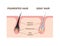 Mechanism of pigmented hair and gray hair / comparison vector illustration