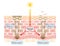 Mechanism of skin cell turnover illustration. Melanin and melanocytes in human skin layer. beauty and skin care