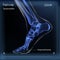 Medial view x ray of bones the of foot with sesamoid.