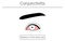 Medical Clipart, Line Drawing Illustration of Eye Disease and Conjunctivitis