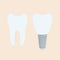 Medical denture. Human teeth, dentist implant in cartoon flat style.