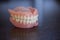 Medical denture on wooden table