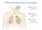 Medical diagram for explain about what coronavirus does to the body.