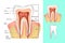 Medical diagram of the structure of the inside cross-section of the tooth