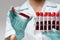 Medical doctor nurse woman wearing protective mask and gloves - holding rack with virus blood tests