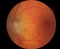 Medical fundus photo of macula