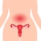 Medical illustration concept of healthy female reproductive system with the uterus and the ovaries.