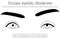 Medical illustration: Diagram of moderate ptosis (eyelid drooping