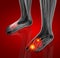 Medical  illustration of the Dorsal Plantar Interossei