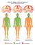 Medical illustration Of Types Of Cerebral Palsy
