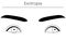 Medical illustrations, diagrammatic line drawings of eye diseases, strabismus and exotropia