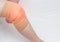 Medical kneecap for fixing the sore knee from arthritis and knee inflammation, for unloading the joint, close-up, copy space