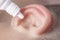 Medical pipette with a drop of medication over the patient`s ear