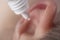 Medical pipette with a drop of medication over the patient`s ear