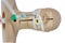 Medical simulation training of tracheal intubation. artificial ventilation of the lungs white background with cipping path