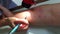 Medical skin prick test for allergy aerosol testing rash reaction