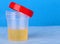 Medical urine test in opened plastic container