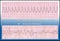 Medicine - Deadly Heart Arrhythmia - VT & VF