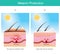 Melanin Production. Illustration showing colour human skin affect from UV rays the cause