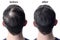 Men hair after using cosmetic powder hair thickening. Before and after