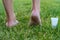 Men`s heels feet with dry skin and scaly with cream on grass