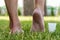 Men`s heels feet with dry skin and scaly with cream on grass