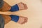 Men`s legs after paresis of the lower extremities with a special blue medical bandage. view from above.