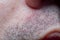 Men`s skin with the remains of a shaved beard in soft focus