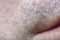 Men`s skin with the remains of a shaved beard in soft focus with strong magnification under the microscope.